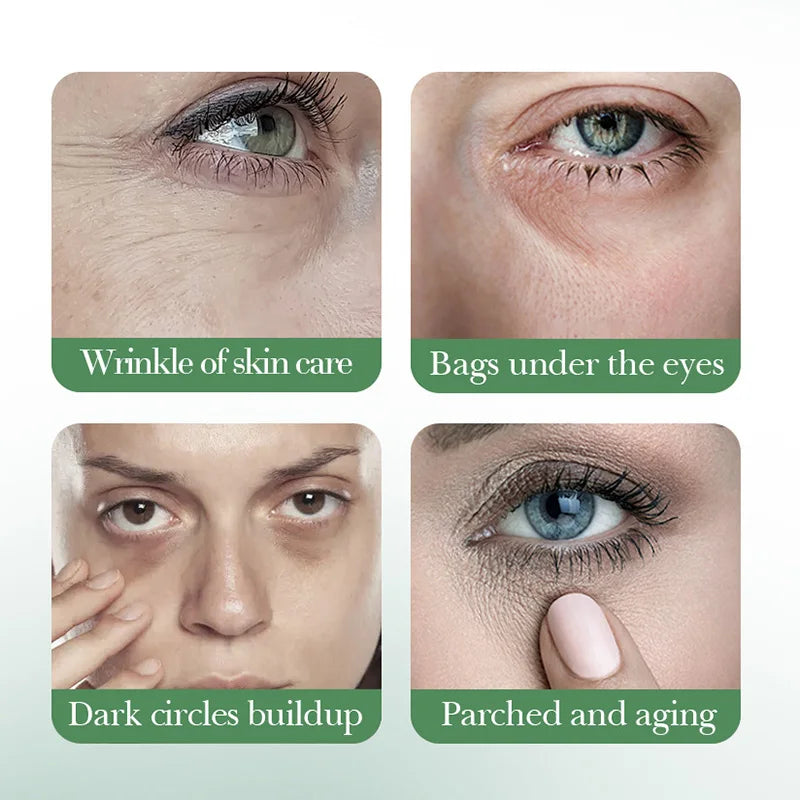 Before and after skincare comparison showing wrinkles, bags under eyes, dark circles, and parched skin.